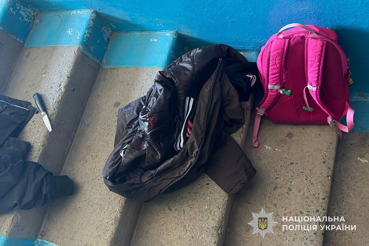 У Тернополі сталася поножовщина між неповнолітніми дівчатами: одну з них забрали в реанімацію. Фото