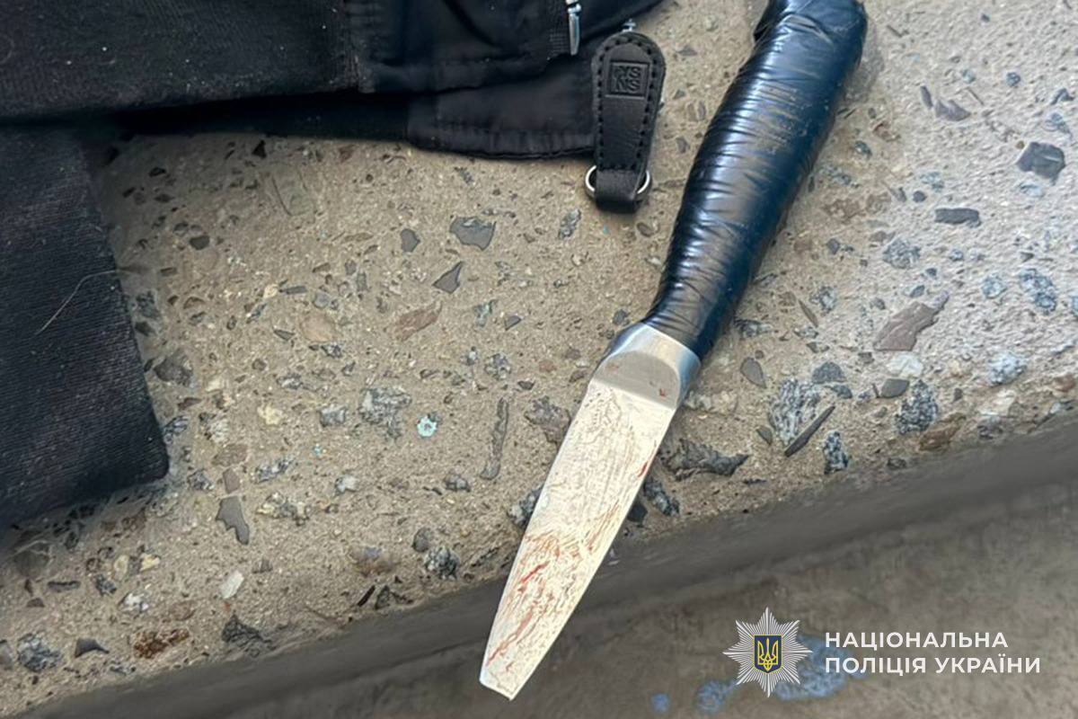 У Тернополі сталася поножовщина між неповнолітніми дівчатами: одну з них забрали в реанімацію. Фото