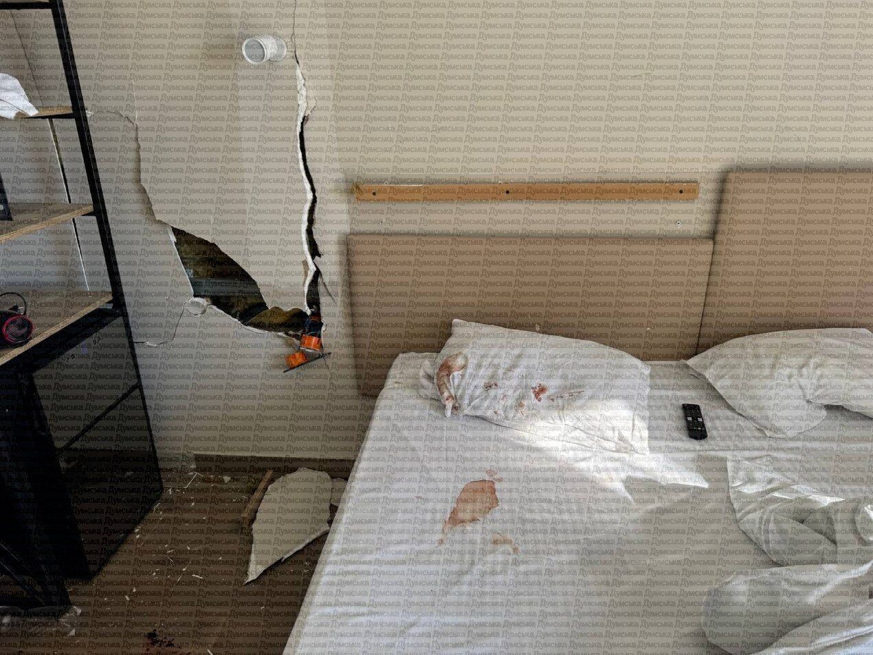 Приехала из Харькова отметить 50-летие: пострадавшая от удара РФ по Одессе рассказала об атаке. Видео