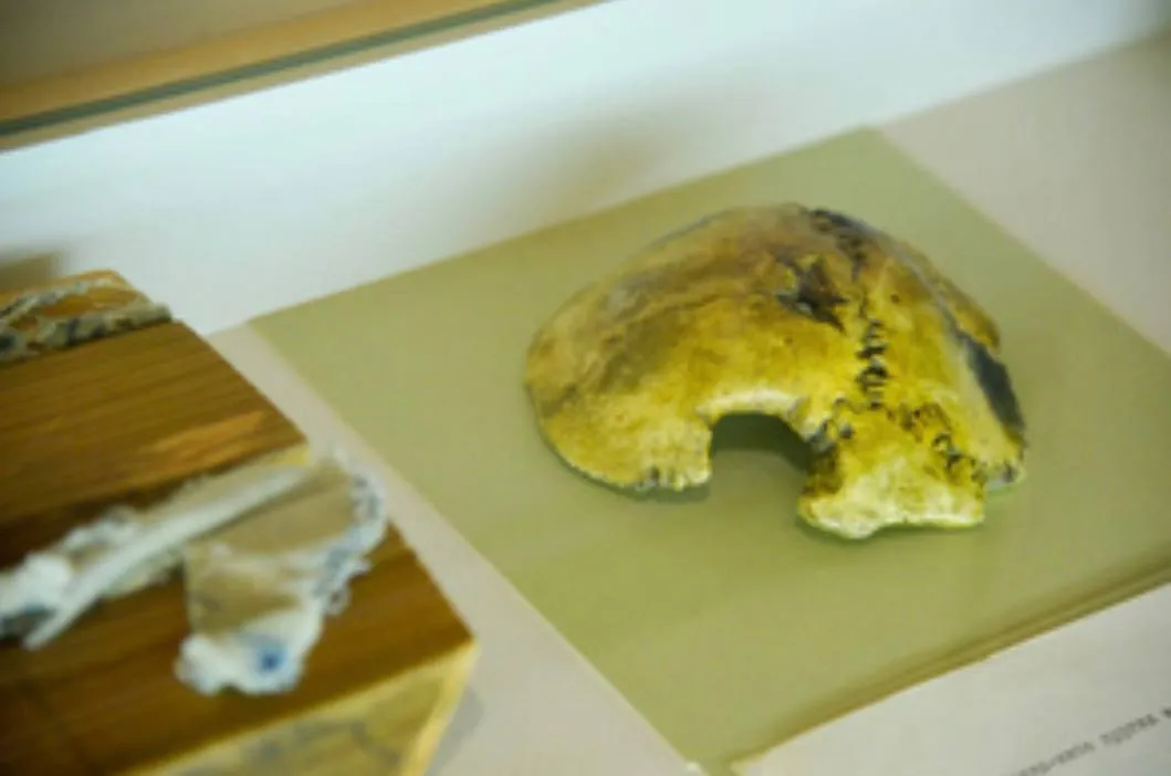 Таємниця "черепа Гітлера", який знайшли в бункері та зберігають в Москві: кому він насправді належить