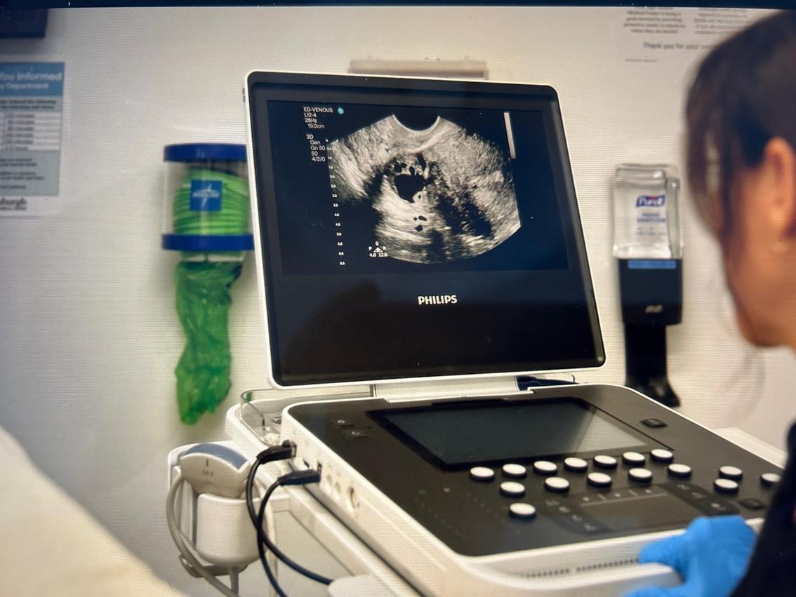 Когда технологии спасают жизни в кадре и в реальности: как работали над созданием сериала "Питт" от HBO Max