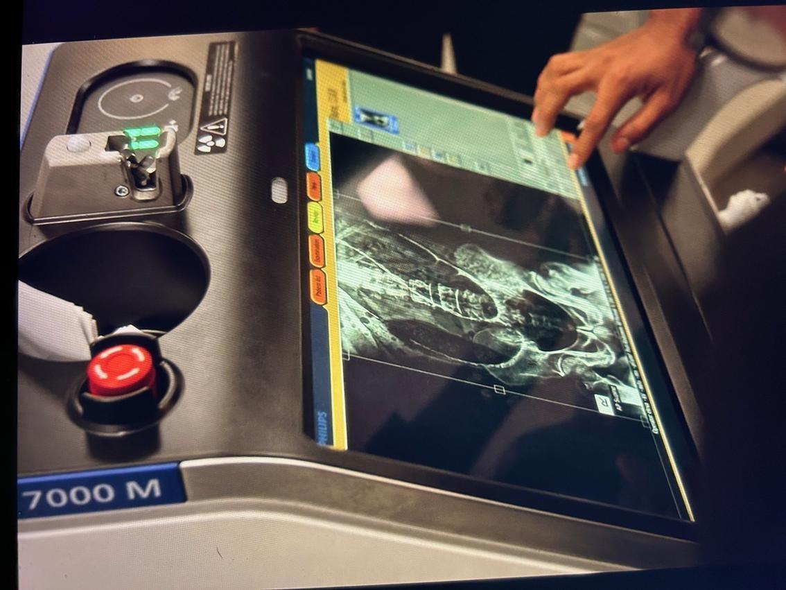 Когда технологии спасают жизни в кадре и в реальности: как работали над созданием сериала "Питт" от HBO Max