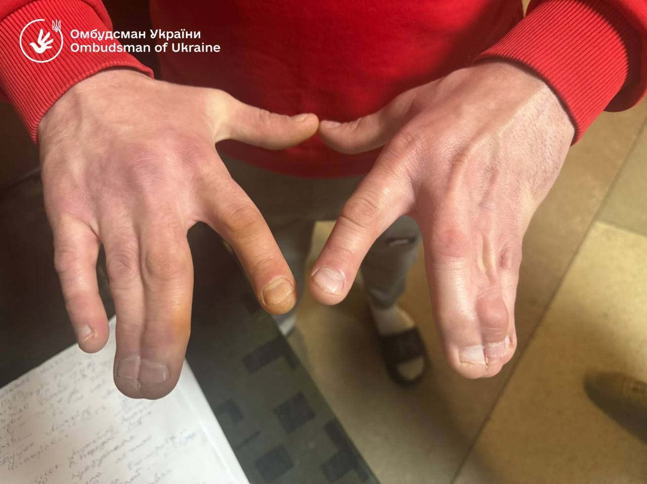 Незаконное содержание и игнорирование болезней: Лубинец показал фото из Ужгородского ТЦК