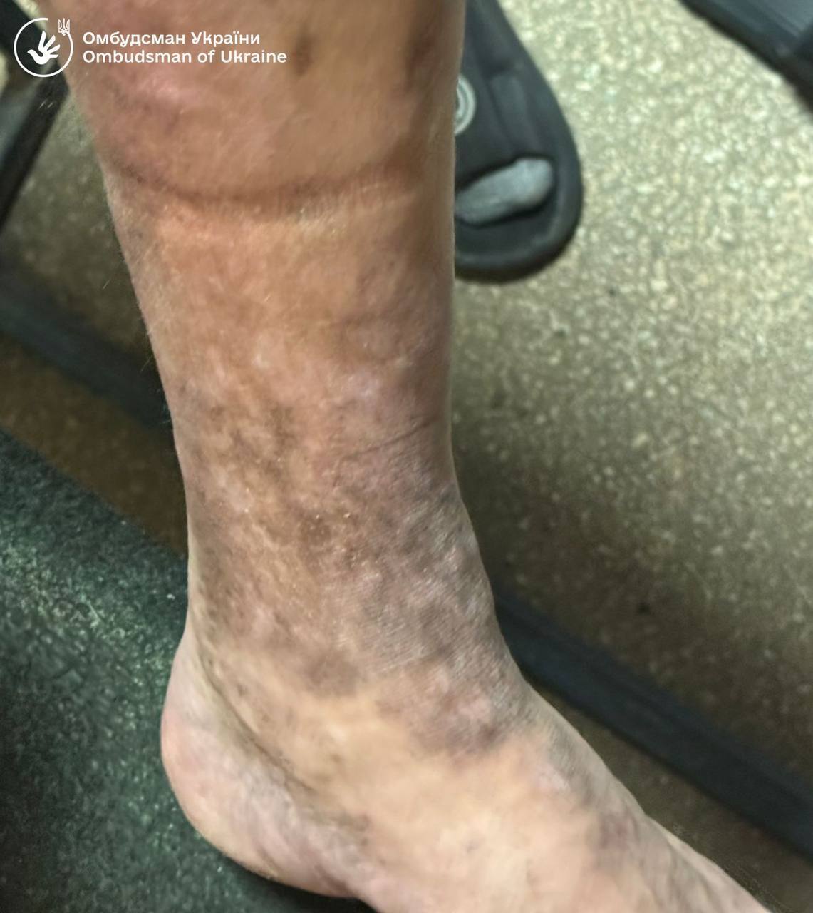 Незаконное содержание и игнорирование болезней: Лубинец показал фото из Ужгородского ТЦК