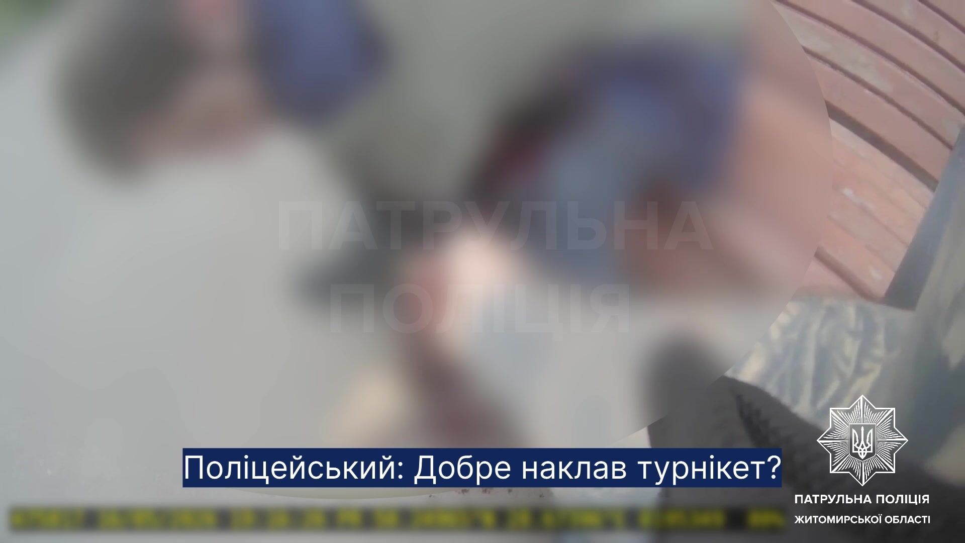 Порезал двух прохожих и бежал по улице с ножом: в Житомире патрульные задержали нападавшего, который находился в СВЧ