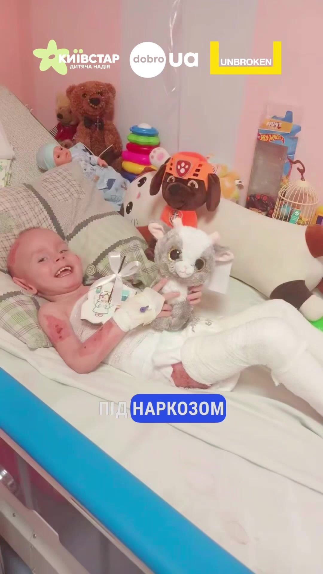 "Шансів майже не було": у Львові врятували 3-річного хлопчика із опіками 70% площі тіла. Відео