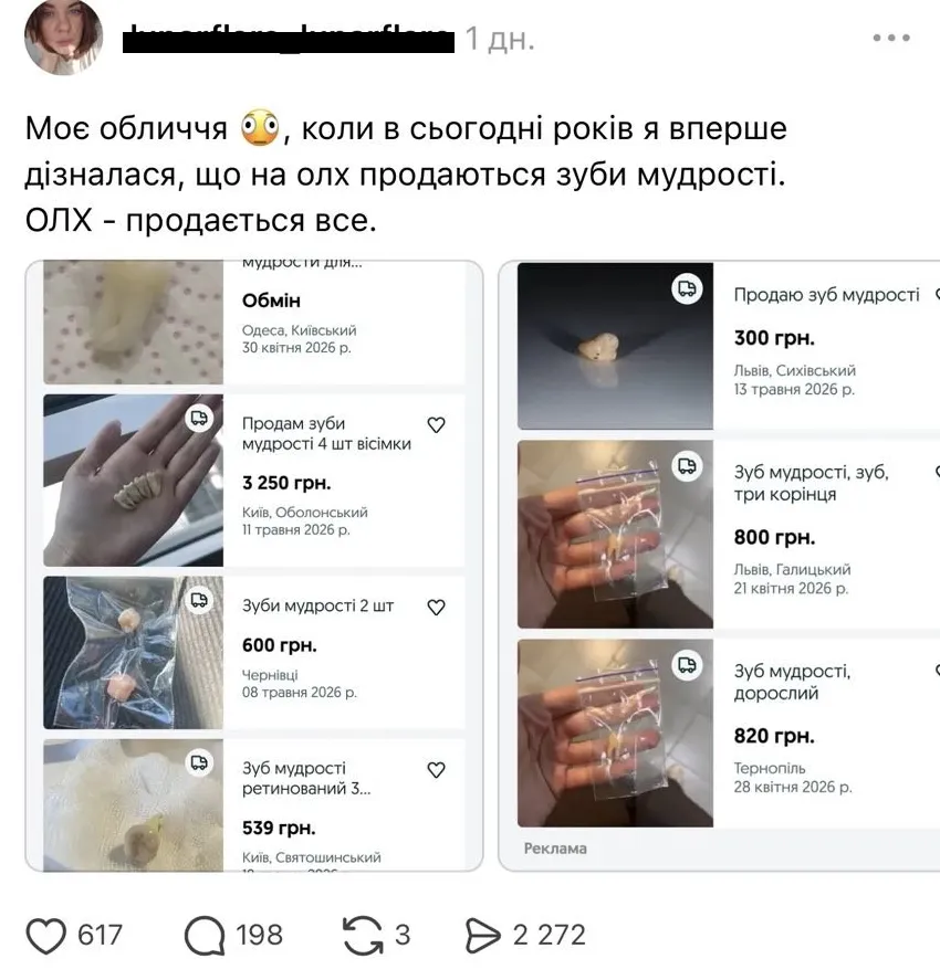 В соцсетях заметили продажу зубов мудрости