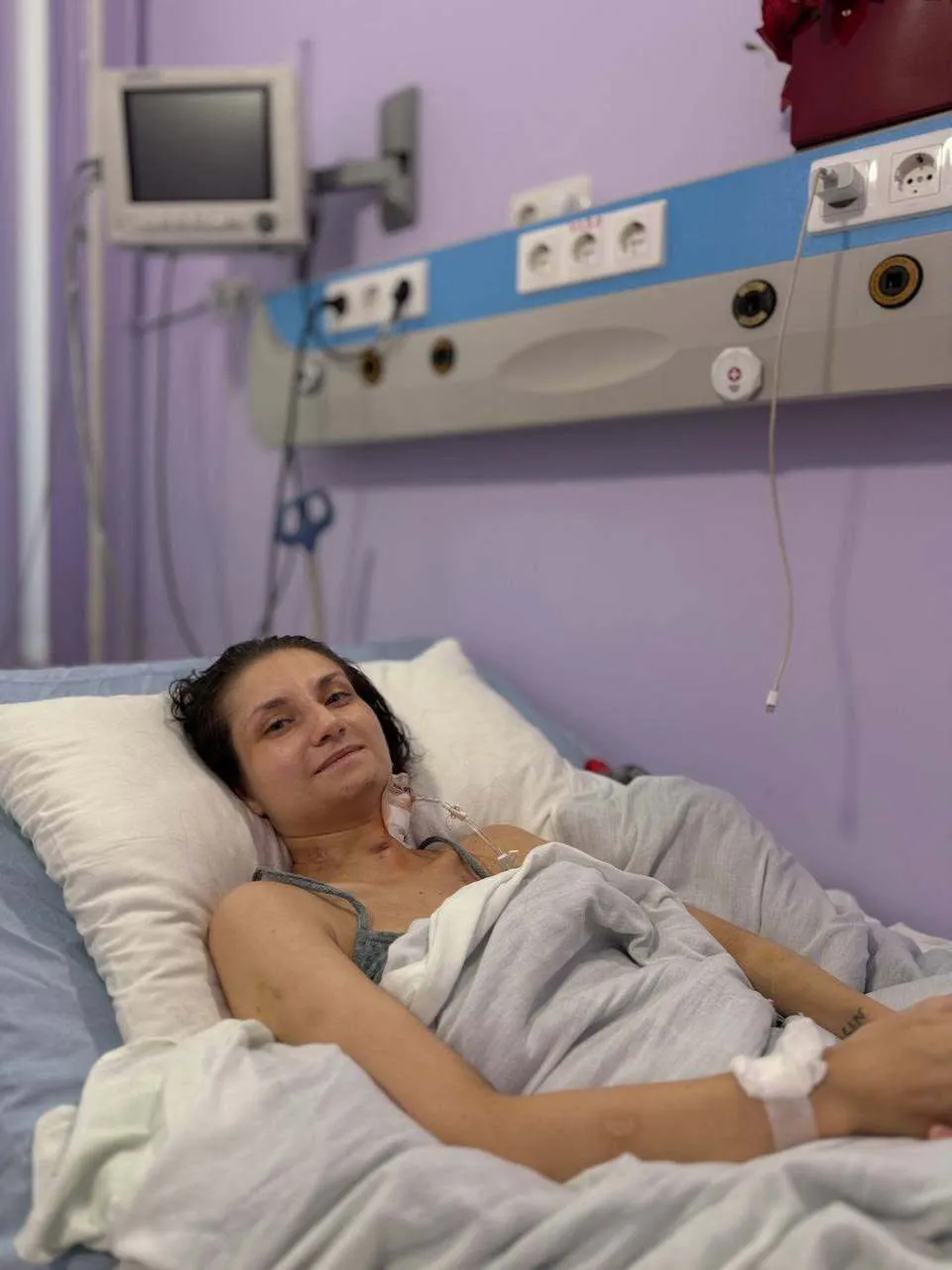 "На 80% не функціонували легені": у Львові врятували жінку з важкою формою пневмонії. Фото