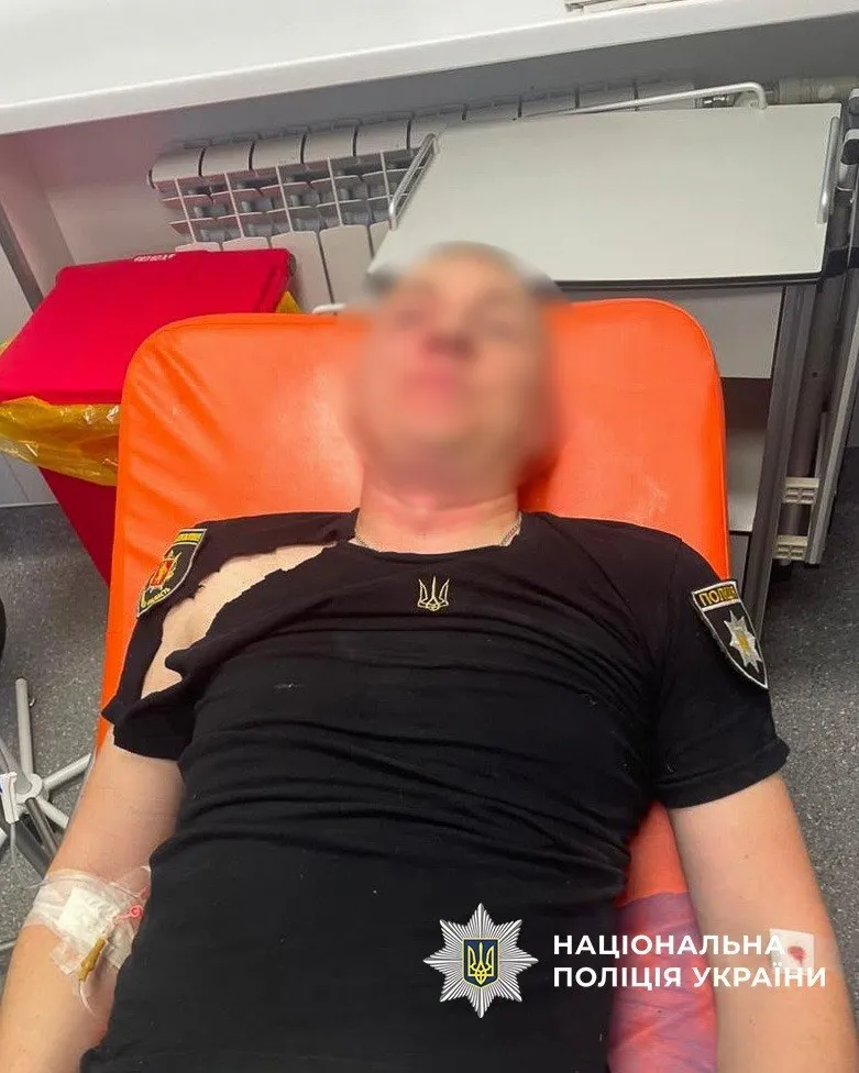 В Запорожье во время обыска вооруженный мужчина ранил трех полицейских: преступника ликвидировали. Фото