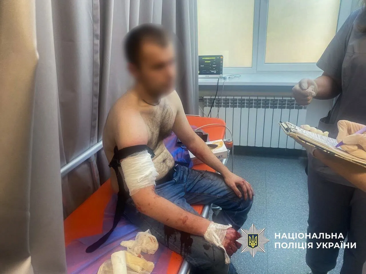 В Запорожье во время обыска вооруженный мужчина ранил трех полицейских: преступника ликвидировали. Фото