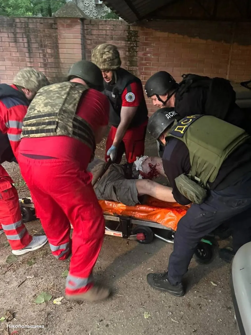 Мирные жители получили ранения