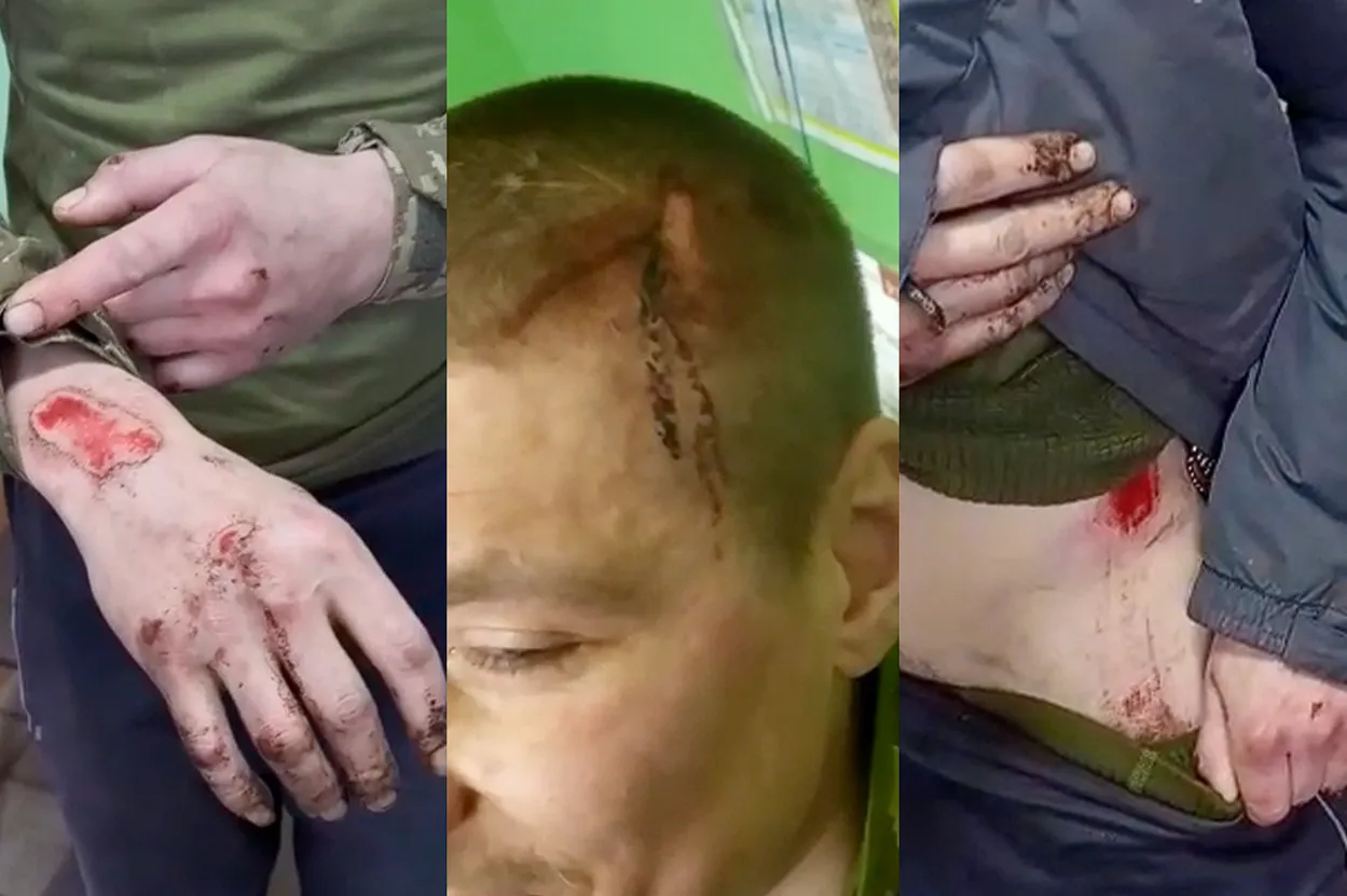 Ситуация в «Скале»