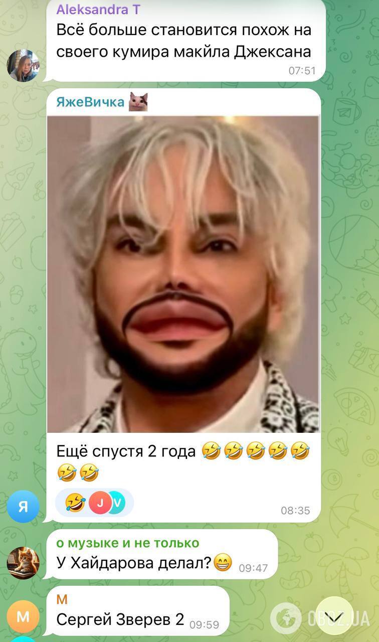 В России подняли на смех Филиппа Киркорова, который сделал очередную пластическую операцию, и объяснили, почему путинист меняет внешность