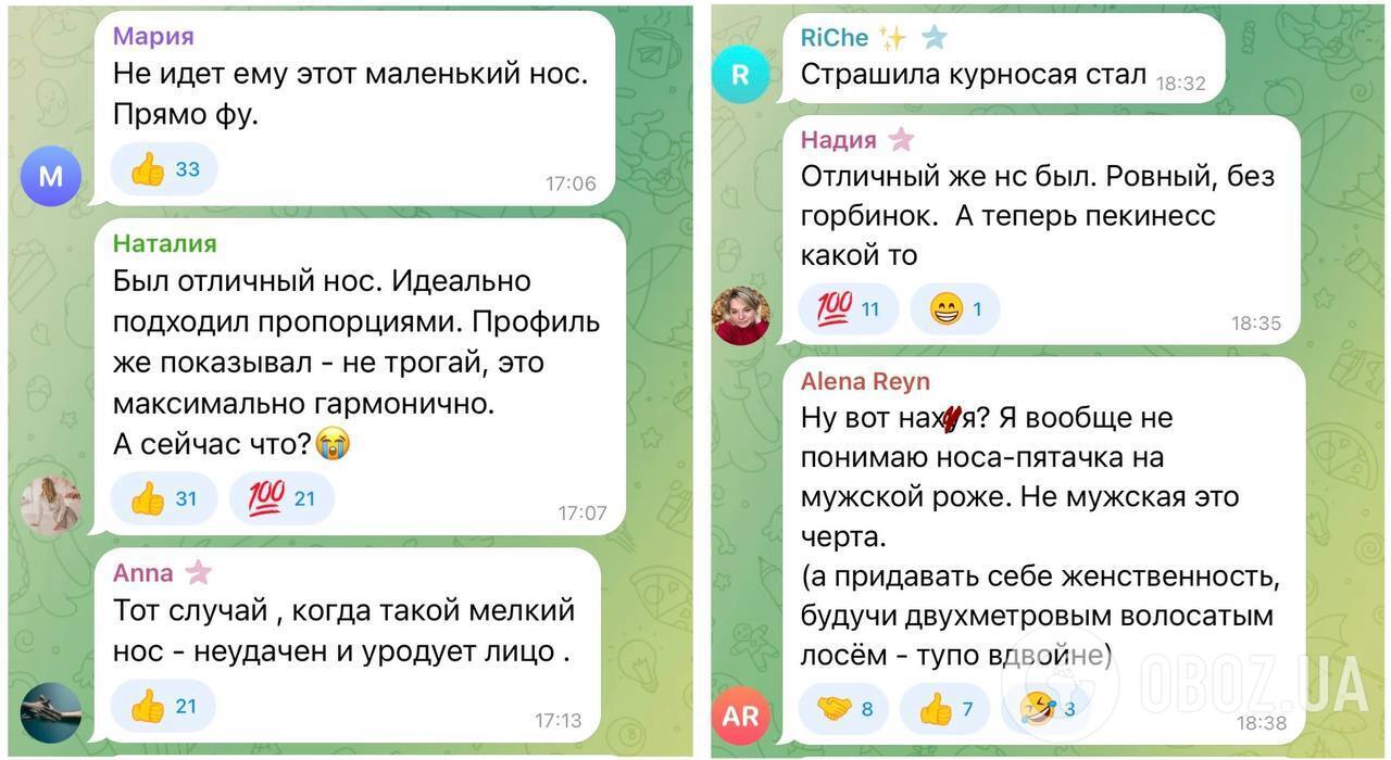 В России подняли на смех Филиппа Киркорова, который сделал очередную пластическую операцию, и объяснили, почему путинист меняет внешность