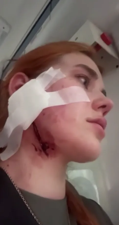 Насте в больнице наложили швы на шею
