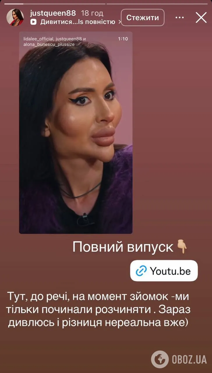 Покрищук планує робити низку пластичних операцій