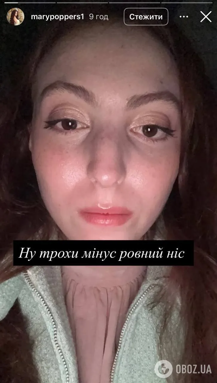 В результате ДТП у Маши Поляковой сломан нос