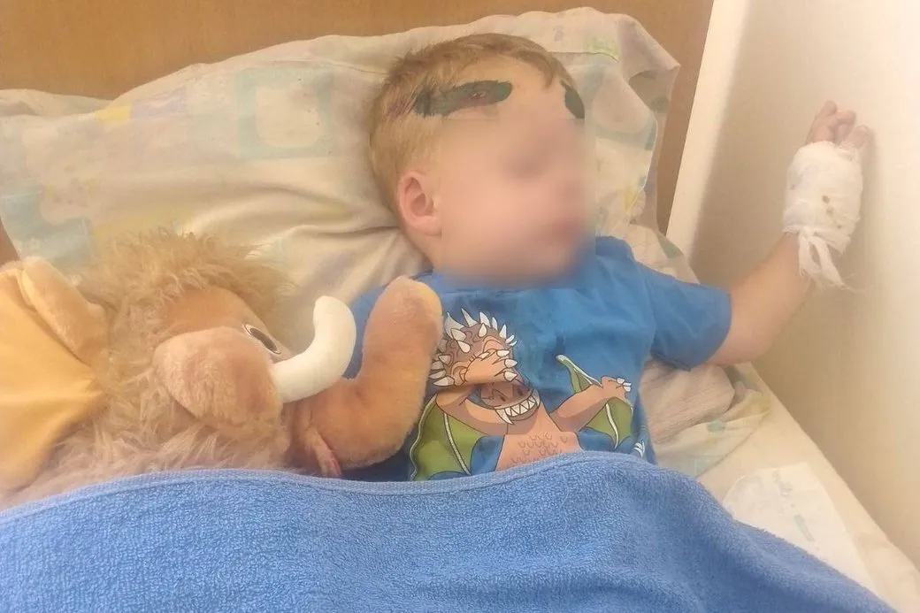 Мальчик, пострадавший в ДТП в Одесской области.