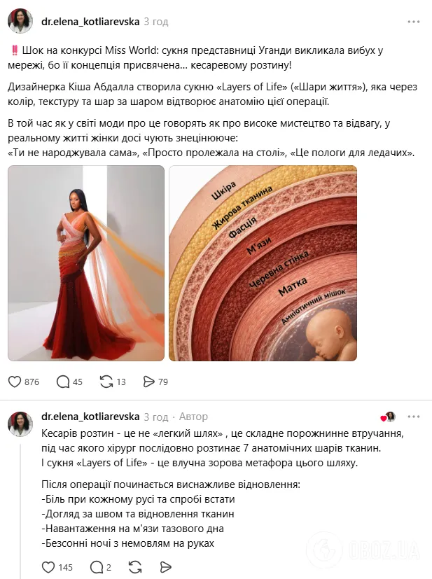 Наряд "Мисс Уганды" поразил украинцев
