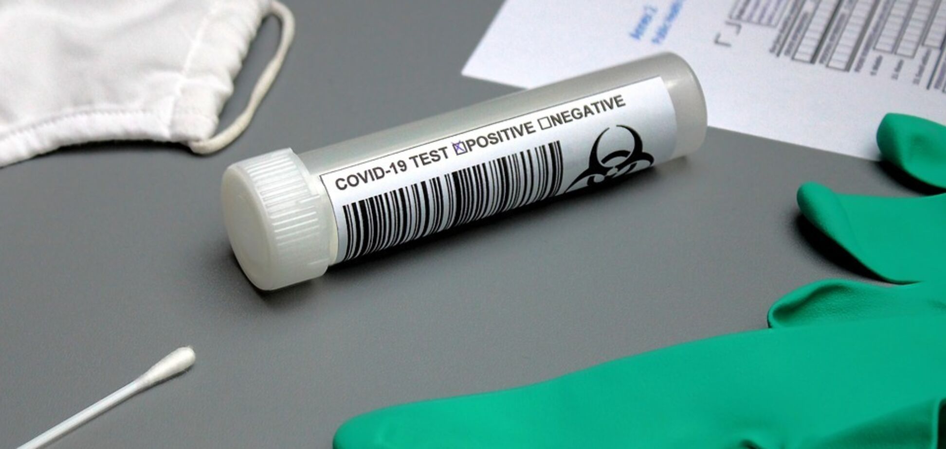 Вірусолог розкрив правду про тести на антитіла до коронавірусу