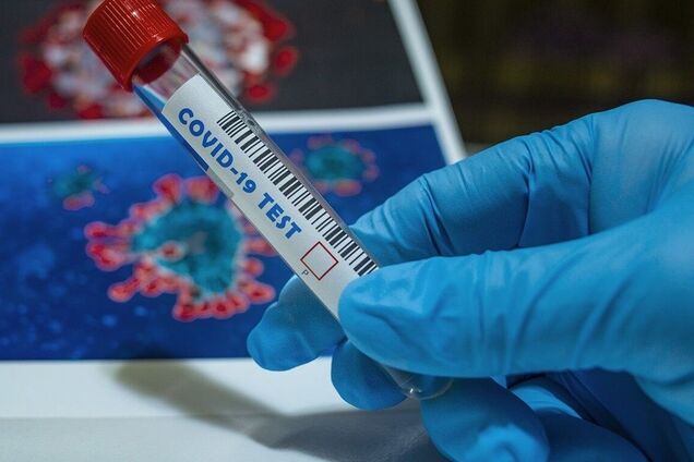 В Днепре за сутки увеличилось количество летальных случаев COVID-19