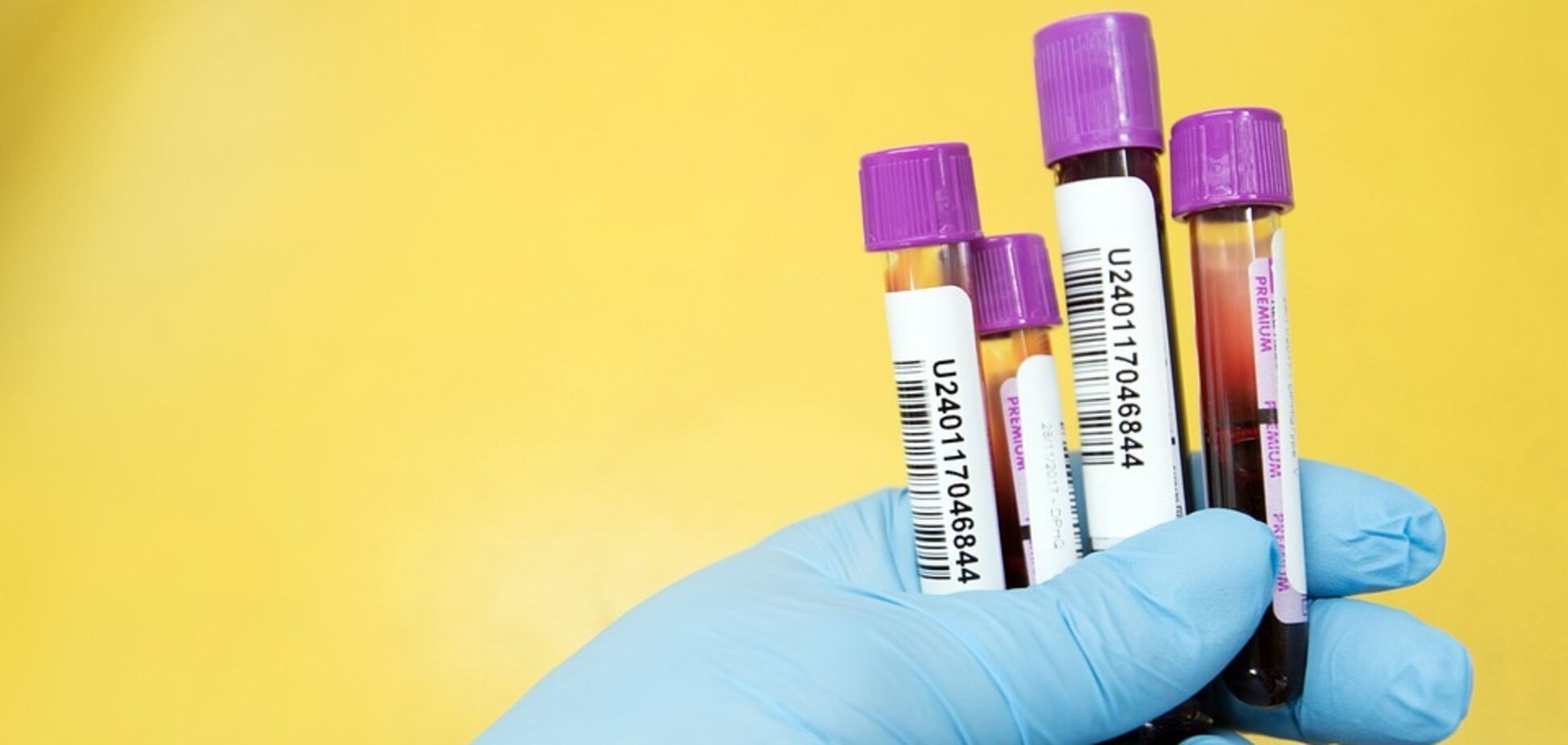 Существует два основных типа тестов на коронавирус