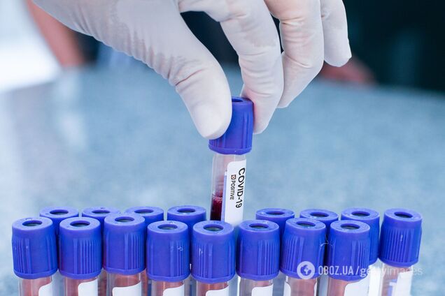 Лікування коронавірусу антитілами