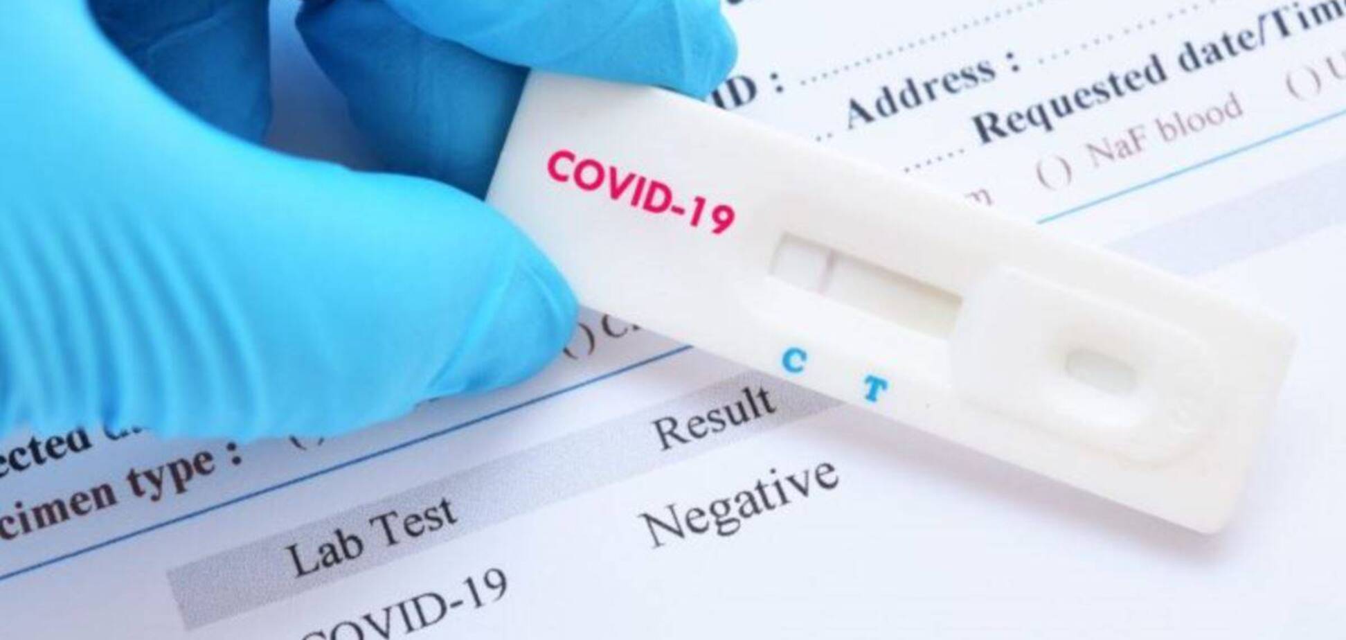 Тест на коронавирус