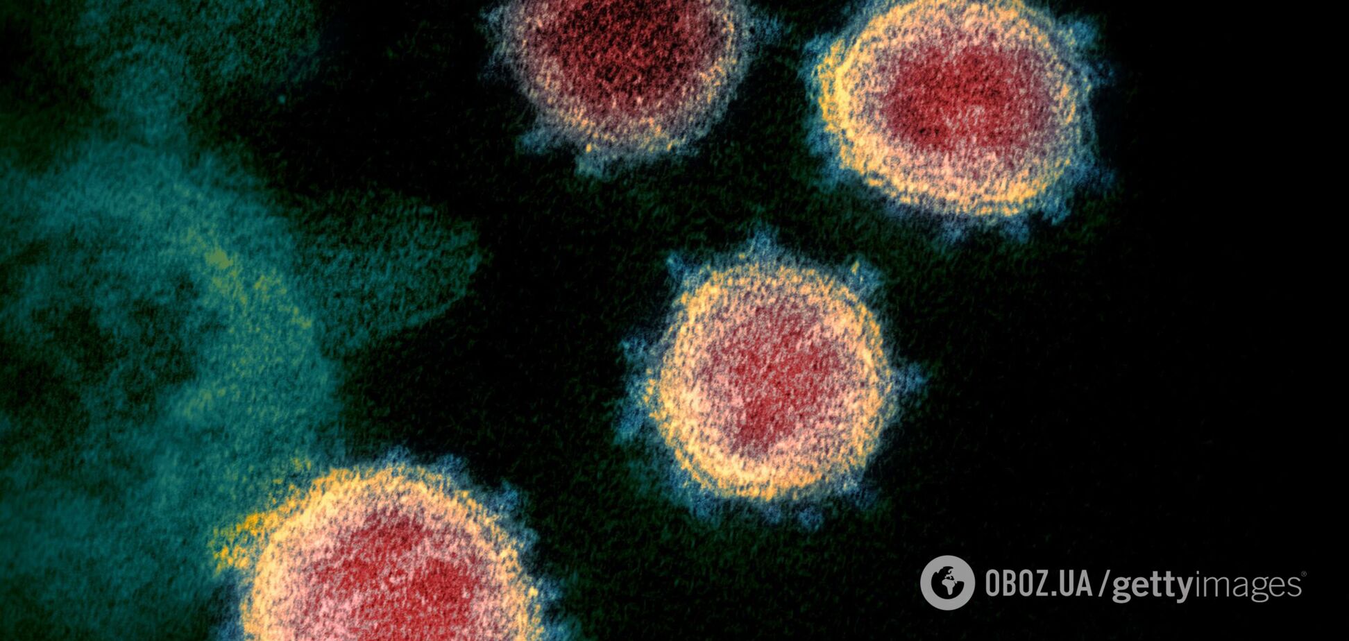 Коронавирус может исчезнуть сам, – академик НАН