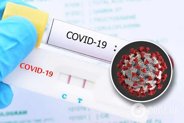 Чому помиляються ПЛР-тести на коронавірус в Україні: вірусологи назвали головні причини