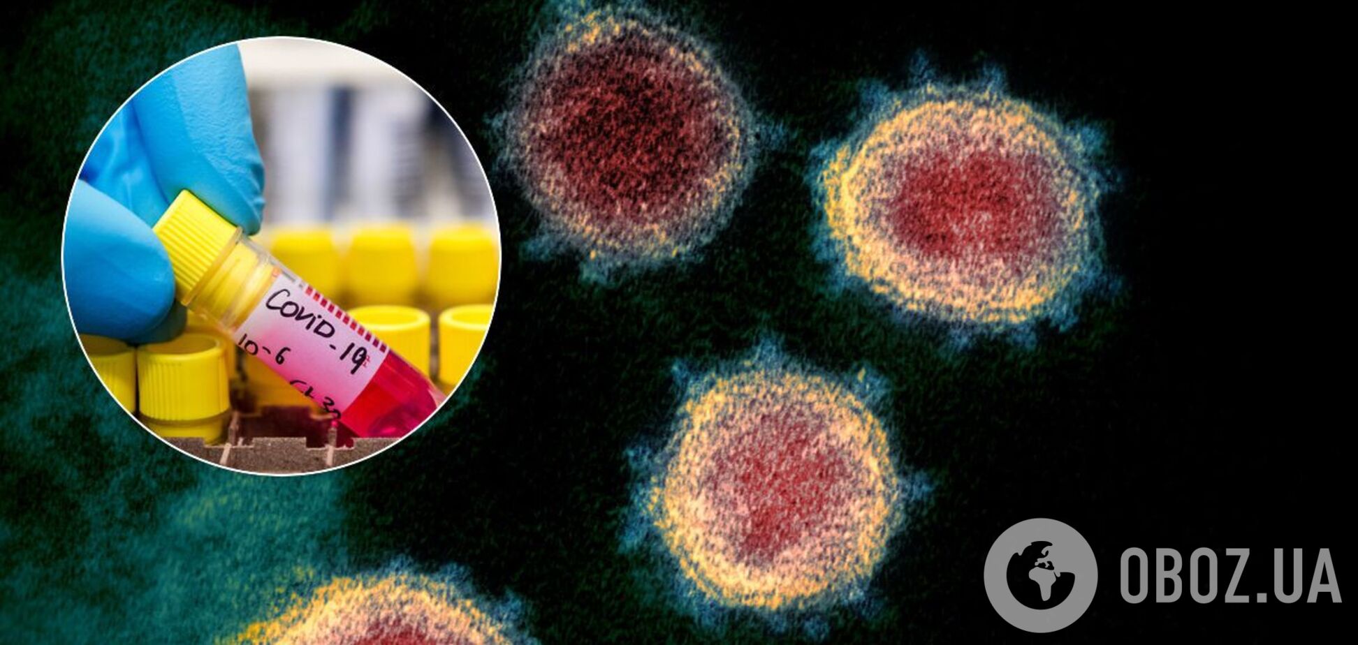 Вакцина от COVID-19 может появиться слишком поздно, – инфекционист
