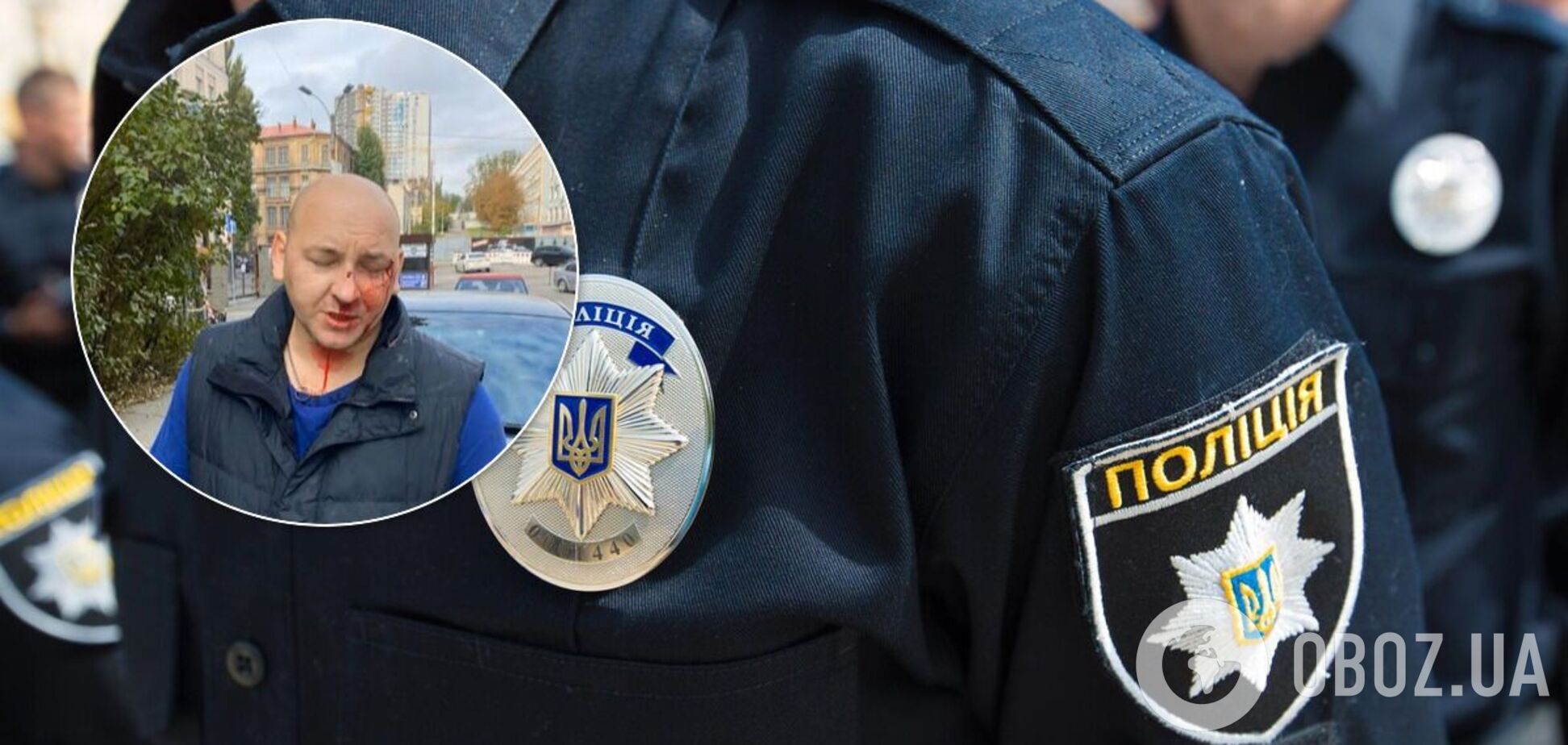 В Киеве избили ветерана АТО
