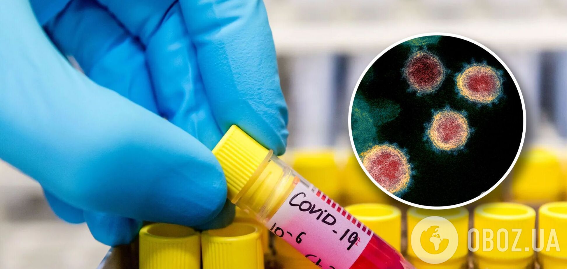 После выборов COVID-19 в Украине пойдет вверх, он не самоликвидируется, – инфекционист