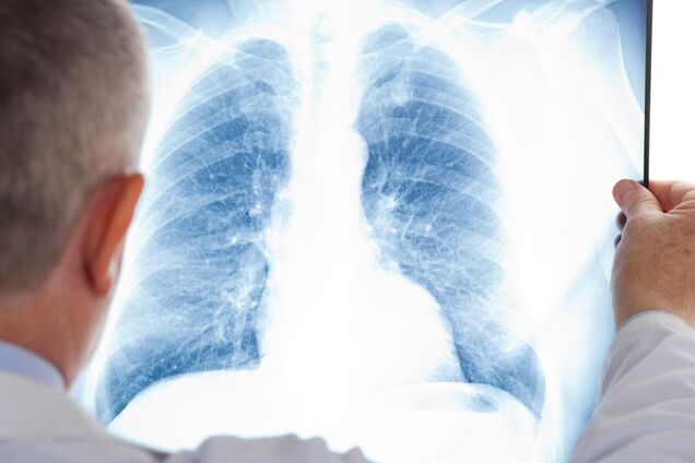 Вчені виростили штучні легені та відстежили, як розмножується COVID-19