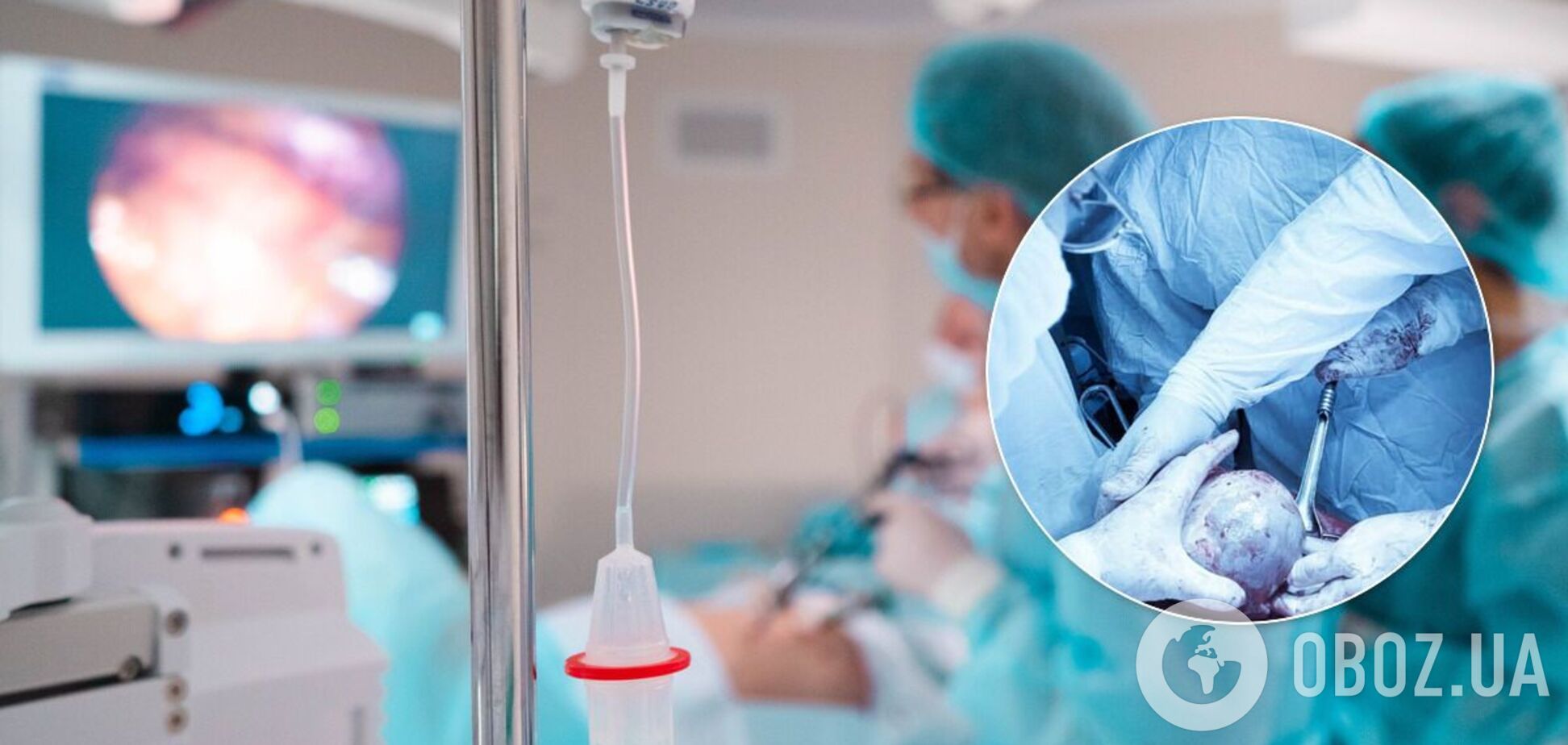 Во Львове 56-летней женщине удалили полуторакилограммовую кисту с паразитами. Фото