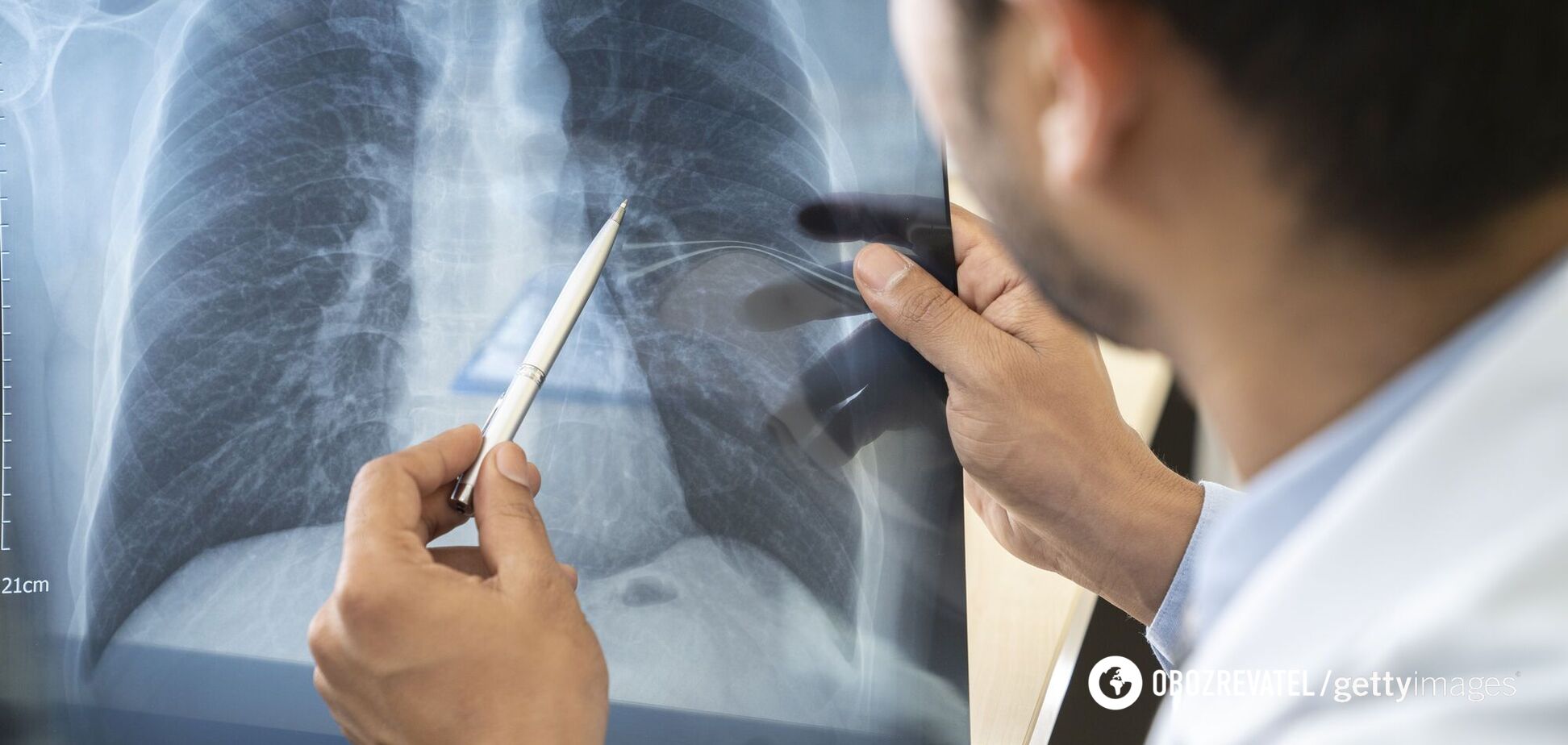 Врач назвал пациентов, у кого коронавирус никогда не вызовет осложнений