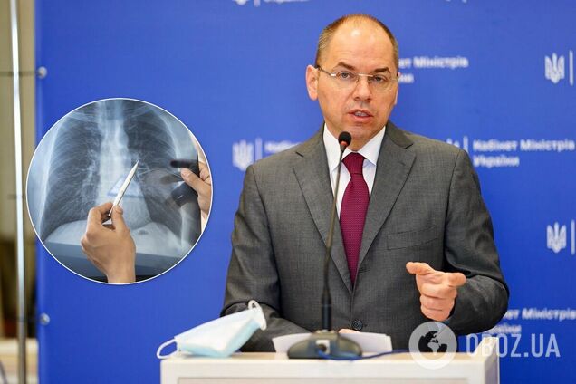 Максим Степанов назвав можливі варіанти розміщення шпиталів для COVID-19