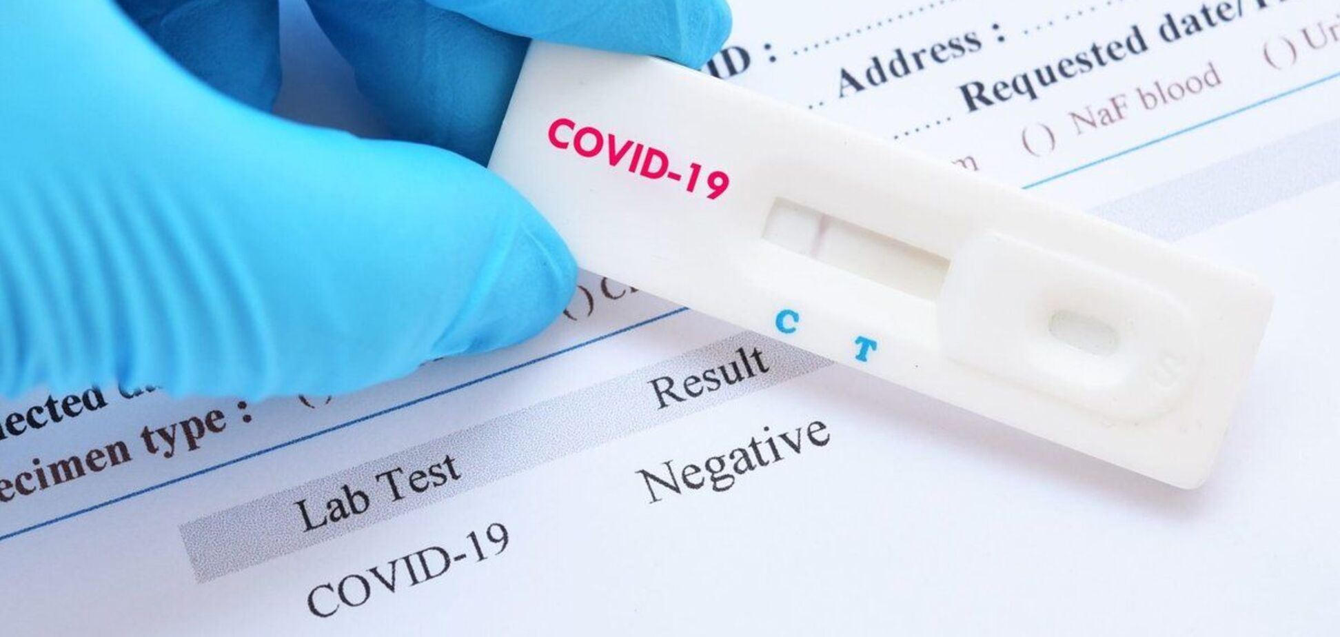 Лікарка розповіла про тести на COVID-19