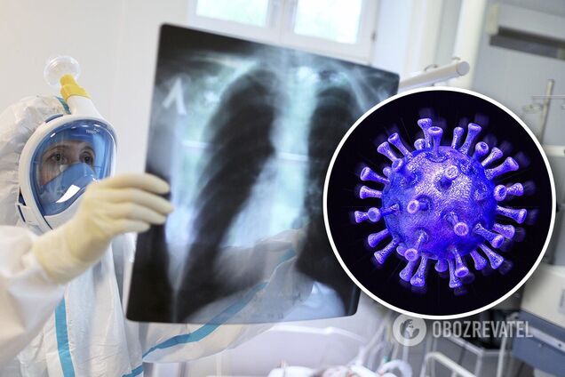 Лікарі розповіли, як відновитися після COVID-19