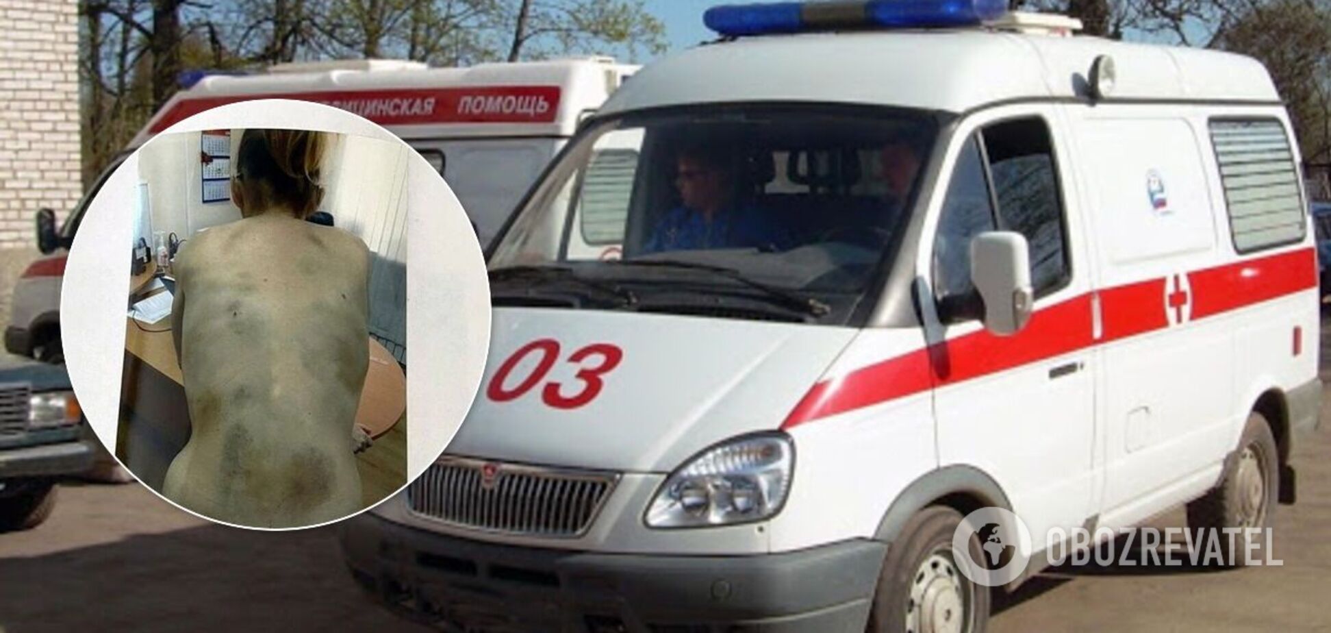 У Росії чоловік-нелюд бив і морив голодом сім'ю: жінка схудла до 35 кг. Фото 18+