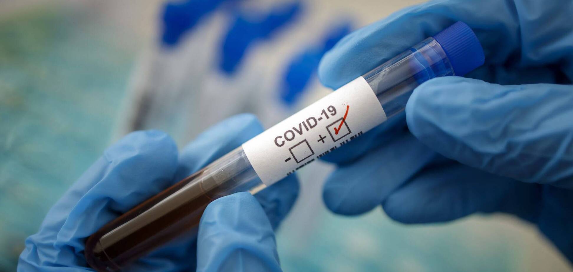 У Дніпрі лікар застрелився через підозру на COVID-19 – ЗМІ