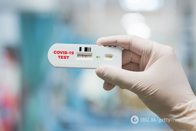 Нові тести на антиген COVID-19 можуть замінити ПЛР, – Степанов