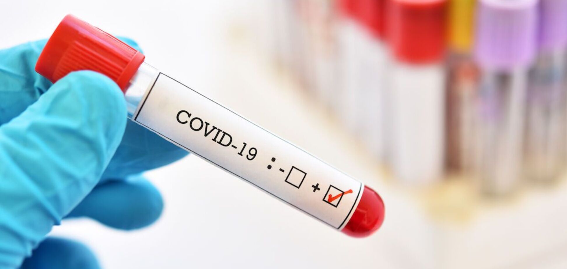 В Днепре за сутки коронавирусом заболели больше 360 человек
