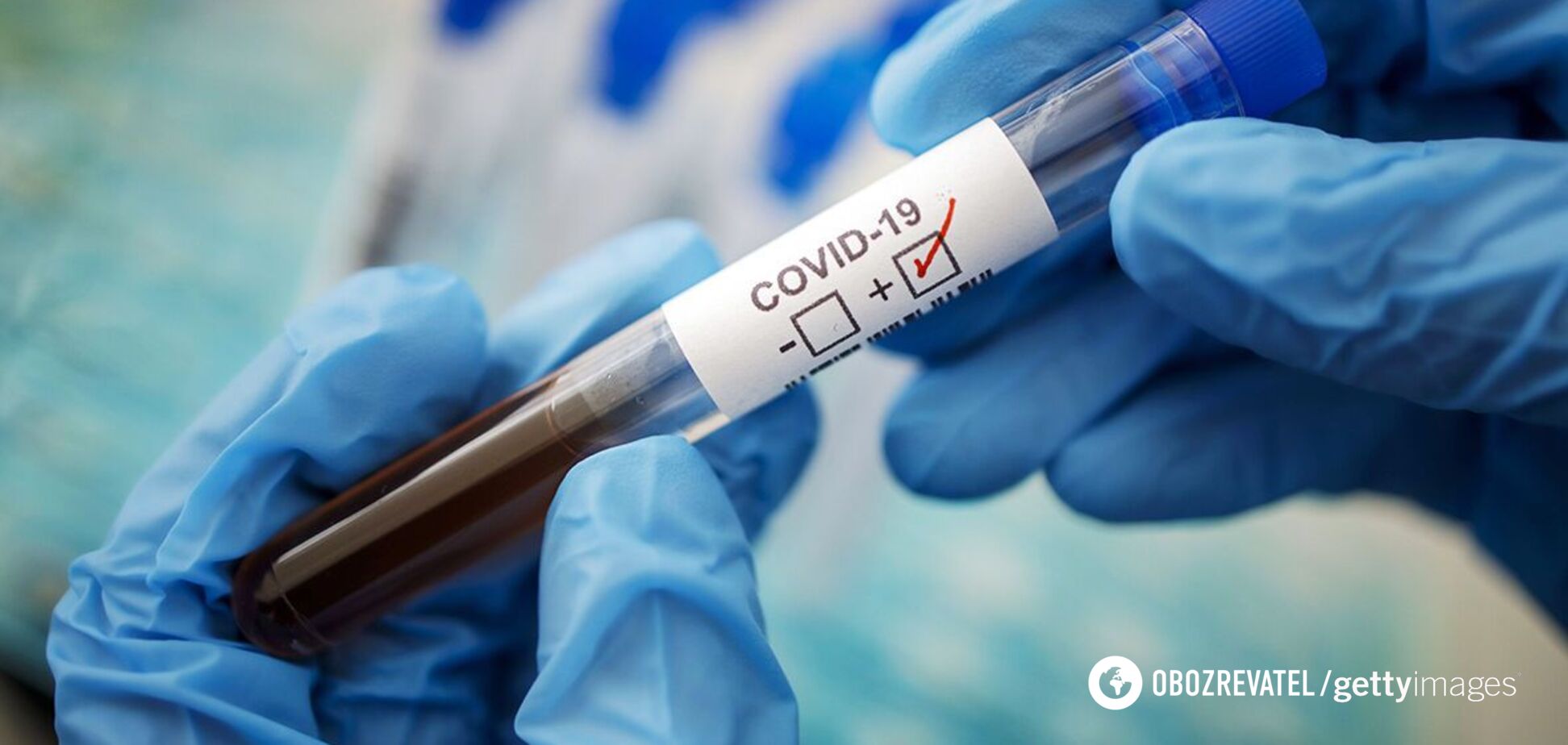 Новий метод визначає коронавірус точніше, ніж тест на антитіла – дослідження
