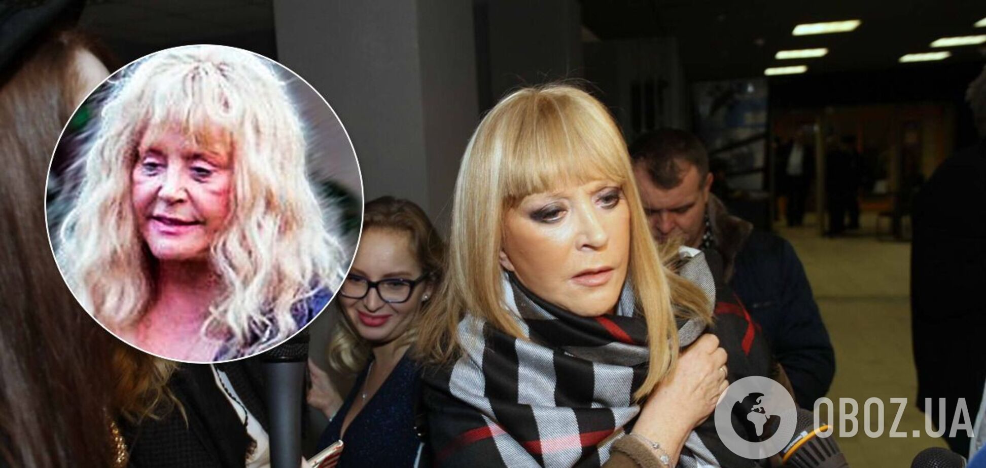 Какие пластические операции делала Пугачева