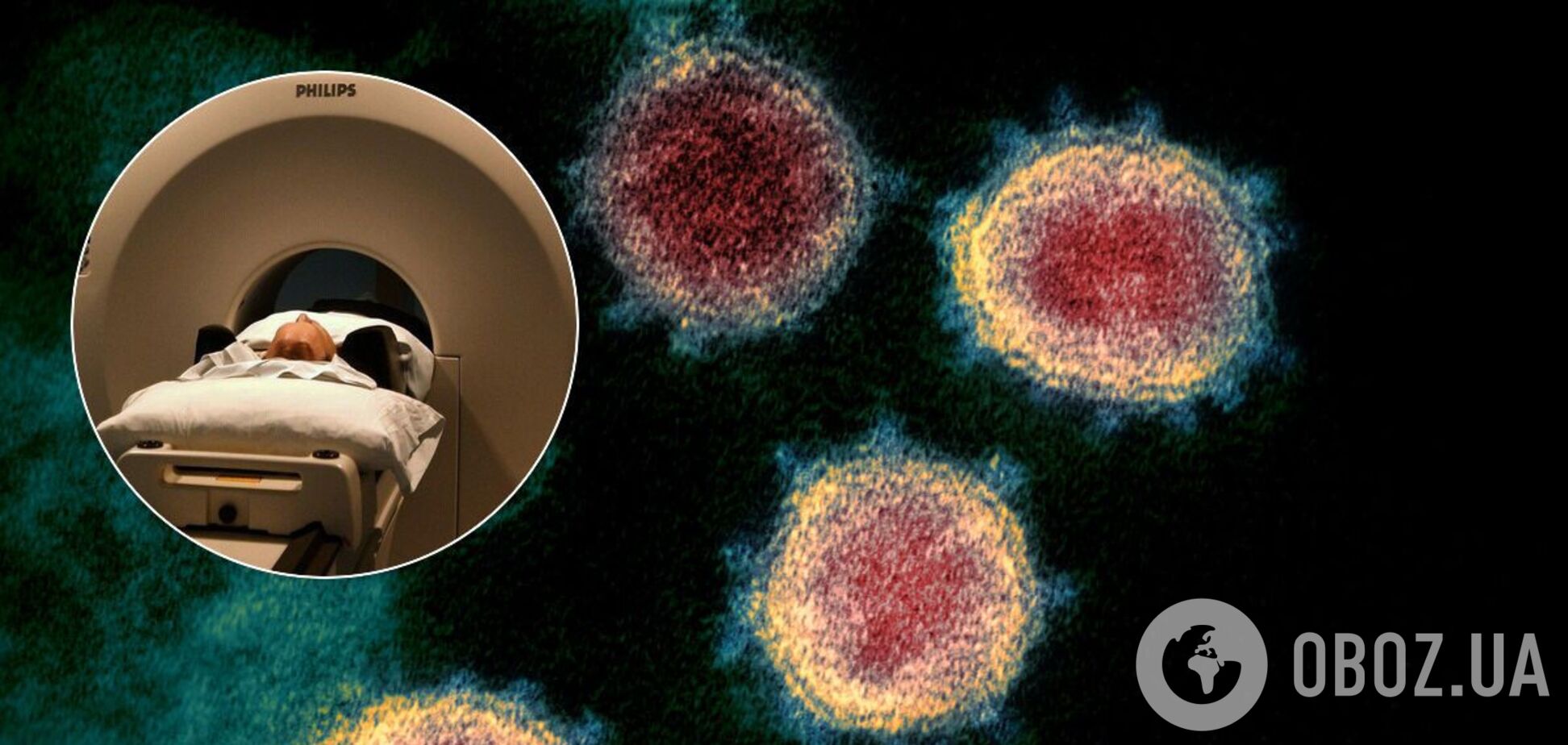 Что нужно проверить тем, кто переболел COVID-19: врач дала советы