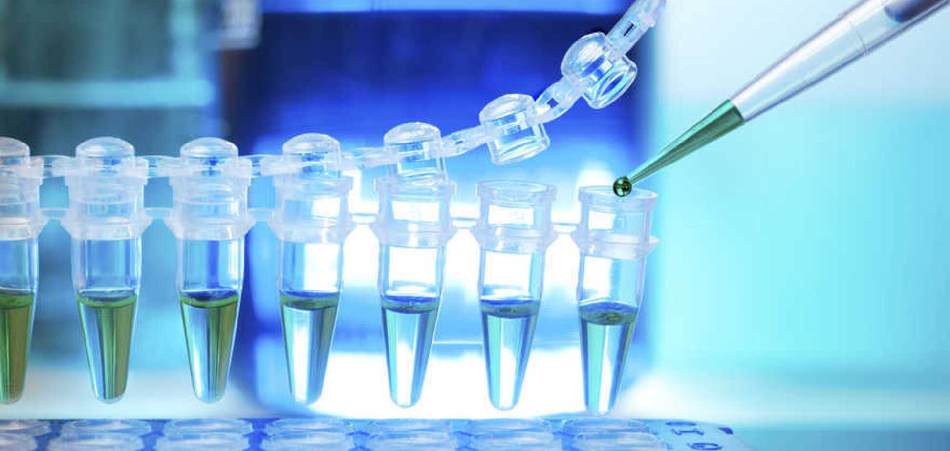 Пандемия коронавируса: в Киеве решили увеличить количество тестирований