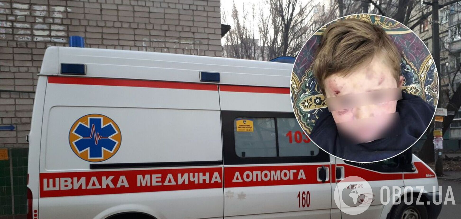 Хлопчика госпіталізували