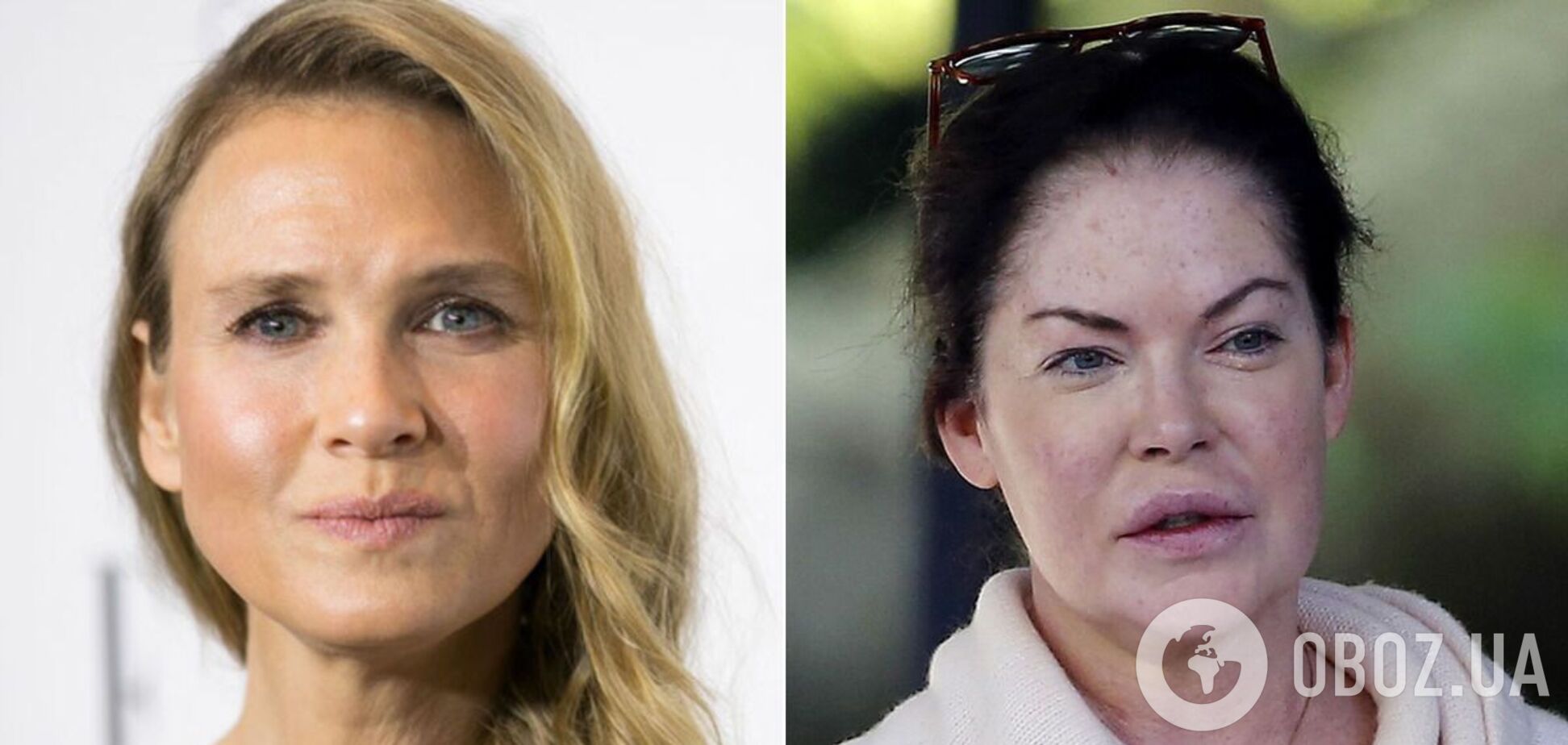 Красавицы, которым пластика стоила карьеры