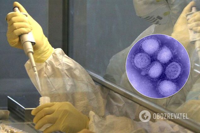 В Канаді людина заразилася рідкісним штамом свинячого грипу
